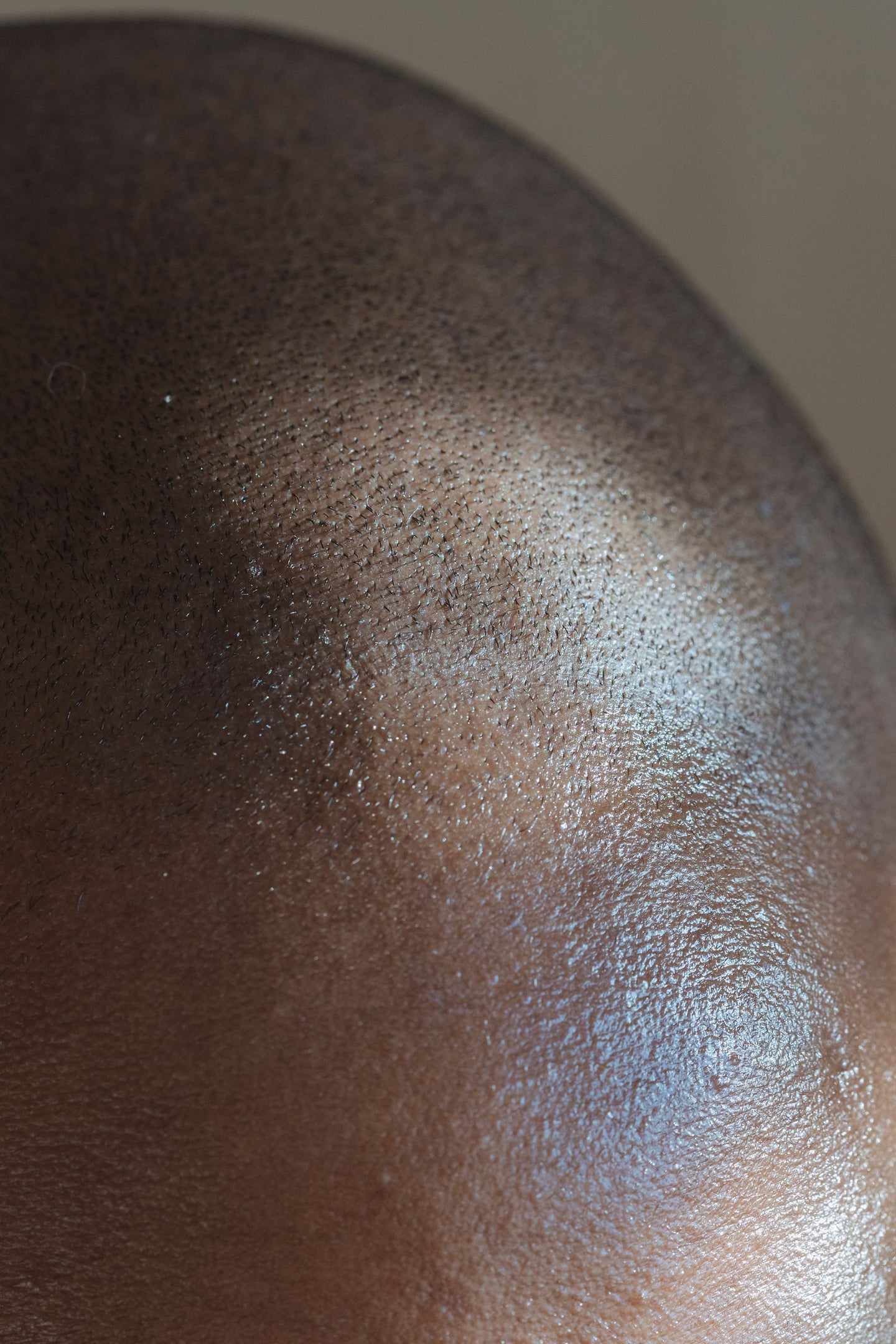 Close view of closely cropped hair and scalp