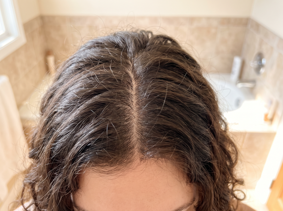 Female hair and scalp close-up
