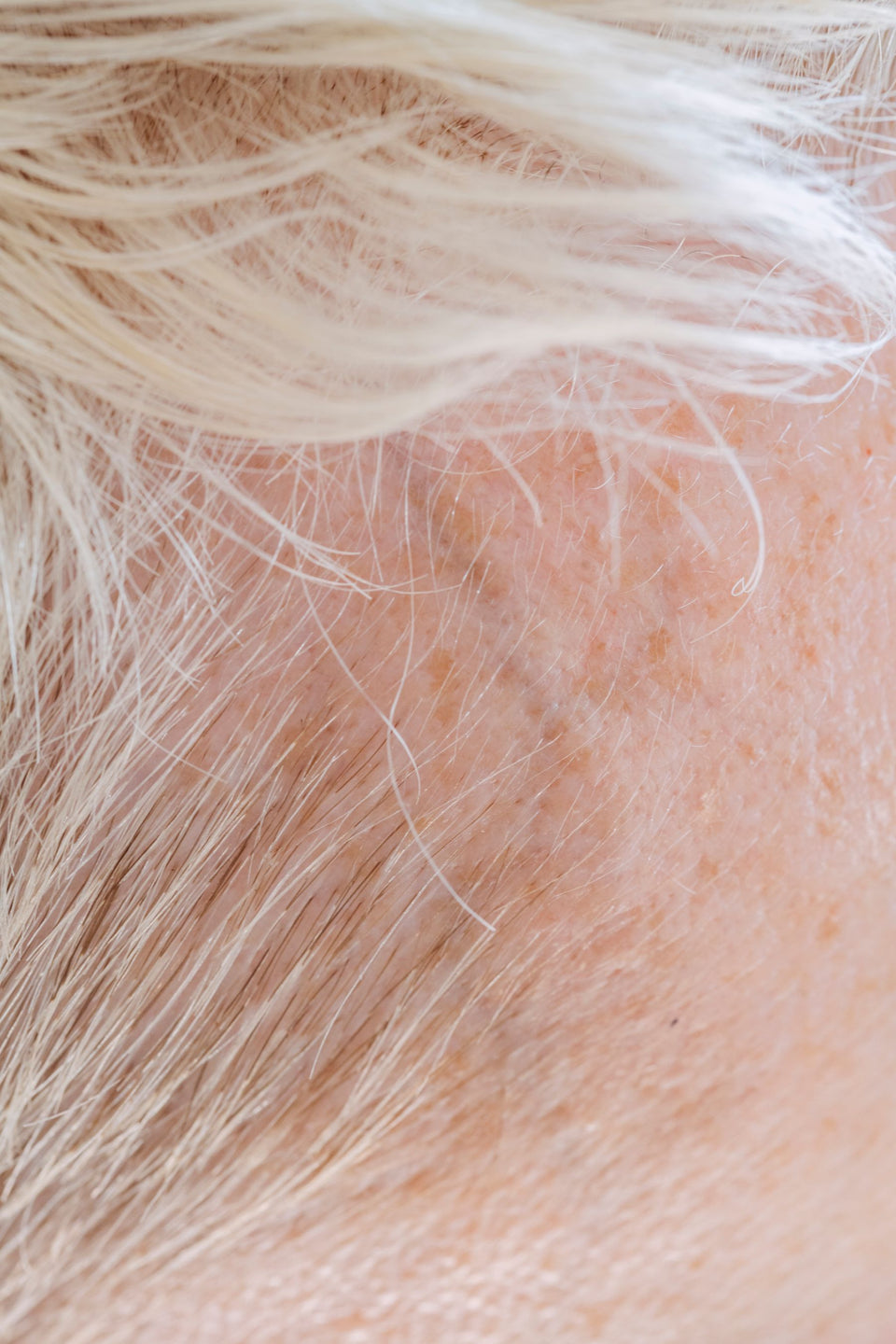 Close view of short white hair along the hairline