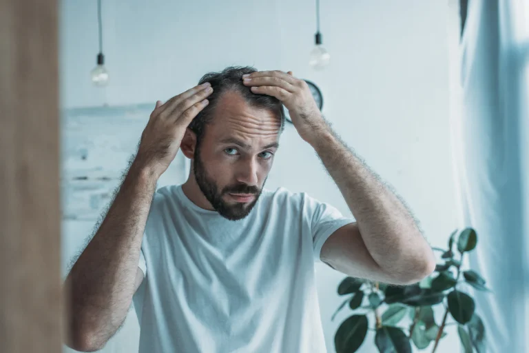 Influence of climate factors on pediatric alopecia areata flares in Philadelphia, Pennsylvania
